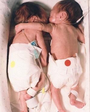 &Epsilon;ί&nu;&alpha;&iota; ί&sigma;&omega;&sigmaf; &alpha;&pi;ό &tau;&iota;&sigmaf; &delta;&iota;&alpha;&sigma;&eta;&mu;ό&tau;&epsilon;&rho;&epsilon;&sigmaf; &phi;&omega;&tau;&omicron;&gamma;&rho;&alpha;&phi;ί&epsilon;&sigmaf; &pi;&omicron;&upsilon; έ&chi;&omicron;&upsilon;&nu; &tau;&rho;&alpha;&beta;&eta;&chi;&tau;&epsilon;ί &pi;&omicron;&tau;έ...