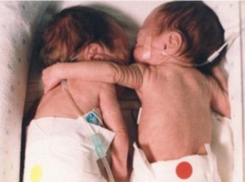 &Epsilon;ί&nu;&alpha;&iota; ί&sigma;&omega;&sigmaf; &alpha;&pi;ό &tau;&iota;&sigmaf; &delta;&iota;&alpha;&sigma;&eta;&mu;ό&tau;&epsilon;&rho;&epsilon;&sigmaf; &phi;&omega;&tau;&omicron;&gamma;&rho;&alpha;&phi;ί&epsilon;&sigmaf; &pi;&omicron;&upsilon; έ&chi;&omicron;&upsilon;&nu; &tau;&rho;&alpha;&beta;&eta;&chi;&tau;&epsilon;ί &pi;&omicron;&tau;έ...