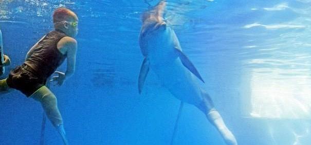 Aπίστευτο: Παιδί με προσθετικά μέλη κολυμπά με δελφίνι με προσθετική ουρά
