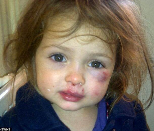 1 Δείτε πώς είναι σήμερα η πεντάχρονη Katie Ann Guttridge