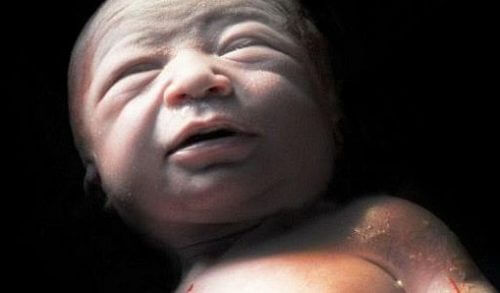 H πρώτη ανάσα: Συγκλονιστικές φωτό καταγράφουν το θαύμα της γέννησης
