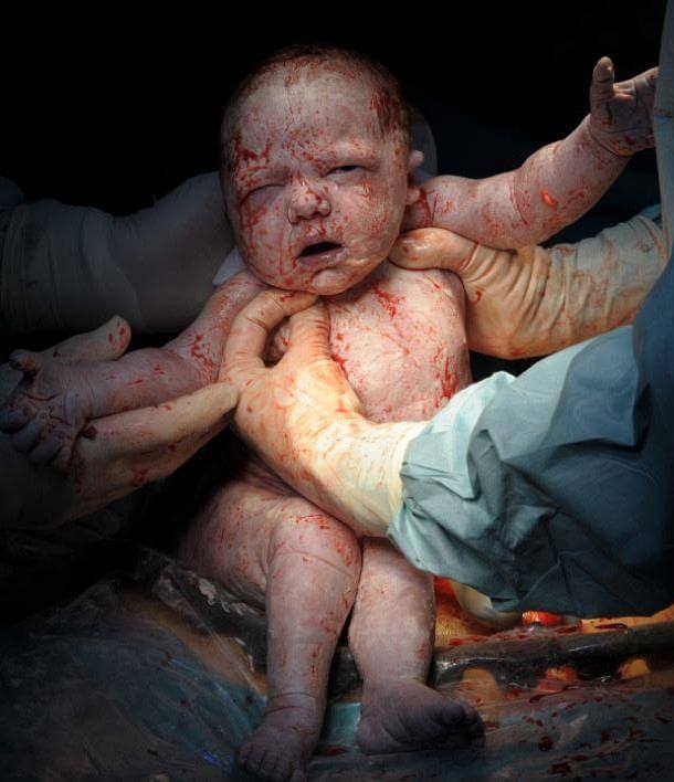 newborn1 H πρώτη ανάσα: Συγκλονιστικές φωτό καταγράφουν το θαύμα της γέννησης