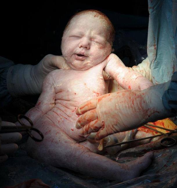 newborn3 H πρώτη ανάσα: Συγκλονιστικές φωτό καταγράφουν το θαύμα της γέννησης