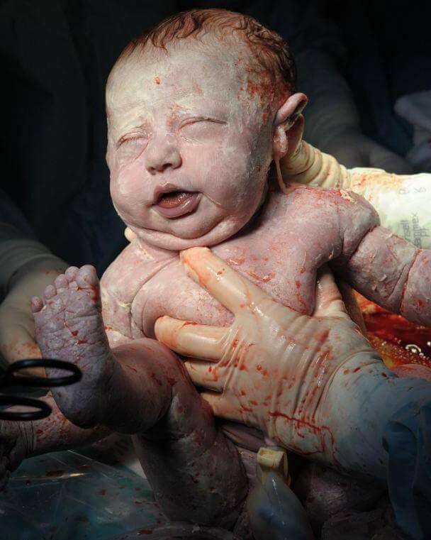 newborn4 H πρώτη ανάσα: Συγκλονιστικές φωτό καταγράφουν το θαύμα της γέννησης
