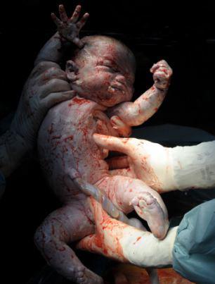 newborn5 H πρώτη ανάσα: Συγκλονιστικές φωτό καταγράφουν το θαύμα της γέννησης