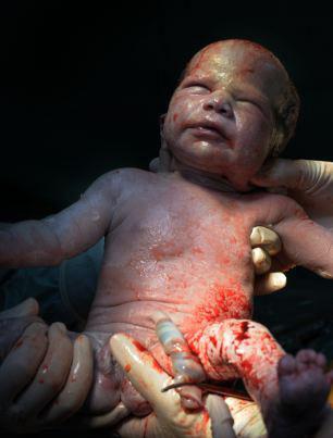 newborn6 H πρώτη ανάσα: Συγκλονιστικές φωτό καταγράφουν το θαύμα της γέννησης