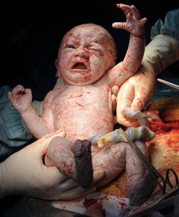 H πρώτη ανάσα: Συγκλονιστικές φωτό καταγράφουν το θαύμα της γέννησης