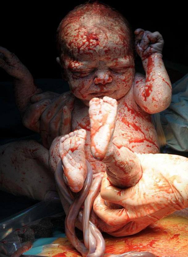 newborn8 H πρώτη ανάσα: Συγκλονιστικές φωτό καταγράφουν το θαύμα της γέννησης
