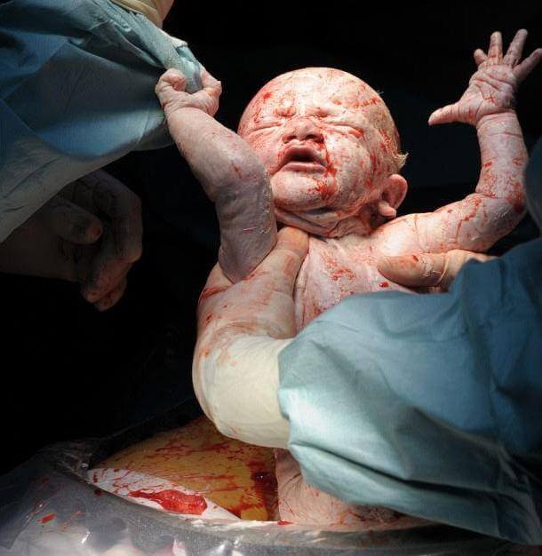 newborn9 H πρώτη ανάσα: Συγκλονιστικές φωτό καταγράφουν το θαύμα της γέννησης
