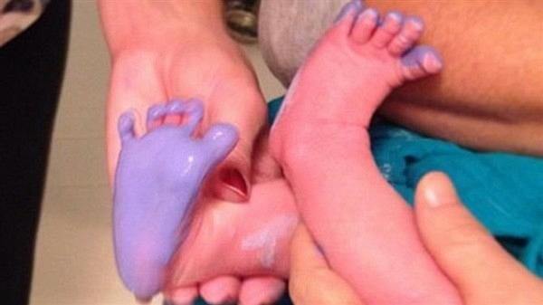 Celebrity μαμά, κράτησε τα πατουσάκια του παιδιού της, ενθύμιο!