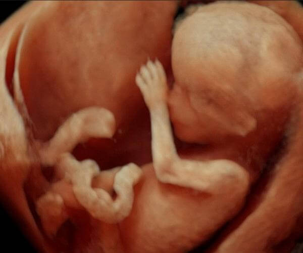 Θα εκτυπώνονται τρισδιάστα HD τα έμβρυα μέσα από την κοιλιά της μητέρας τους