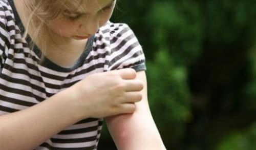 Καλοκαίρι και κουνούπια! Προσοχή στα παιδιά