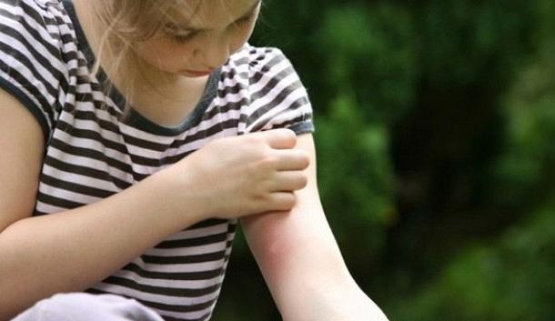 MOSQUITO_KID Καλοκαίρι και κουνούπια! Προσοχή στα παιδιά