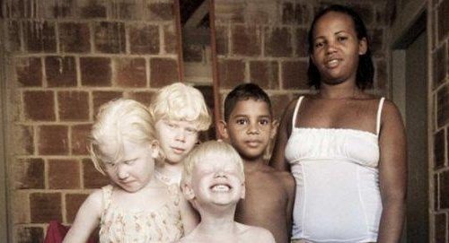 Το μυστήριο με τη μαύρη μητέρα στη Βραζιλία που γεννάει μόνο λευκά παιδιά