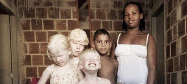 Το μυστήριο με τη μαύρη μητέρα στη Βραζιλία που γεννάει μόνο λευκά παιδιά