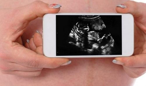 Eίναι ασφαλές να..μιλάω στο κινητό στη διάρκεια της εγκυμοσύνης;