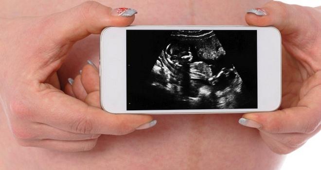 Eίναι ασφαλές να..μιλάω στο κινητό στη διάρκεια της εγκυμοσύνης;