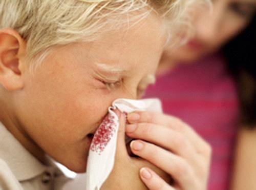 Τι πρέπει να κάνουμε όταν ματώνει η μύτη του παιδιού μας και πότε καλούμε παιδίατρο;