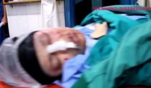 Βραβεύτηκε video εγκύου που χτυπήθηκε από βόμβα και αργότερα γέννησε το μωρό της στη Συρία