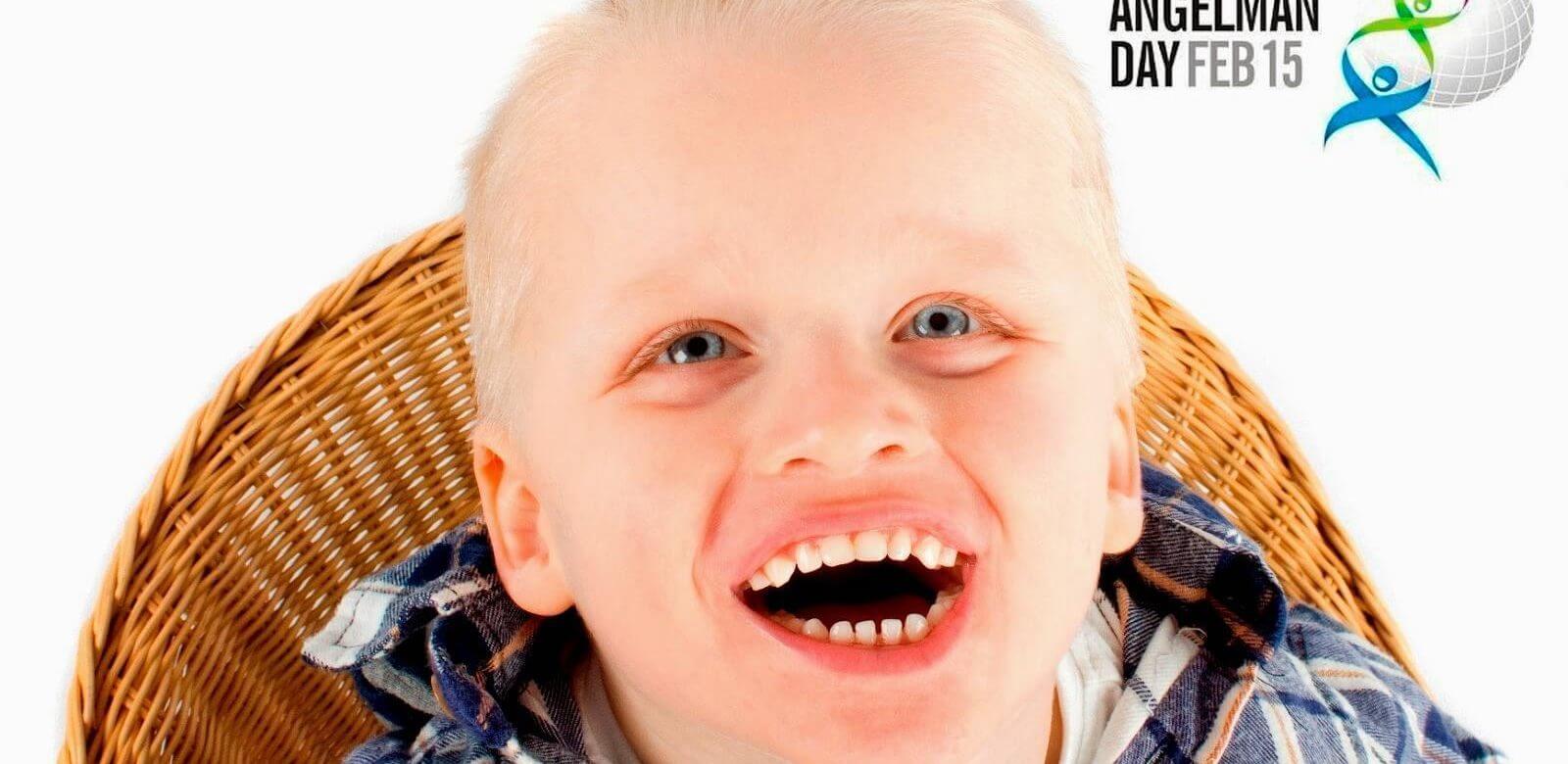 Διεθνής ημέρα συνδρόμου Angelman (Άγγελμαν): Τι είναι και πώς αντιμετωπίζεται;