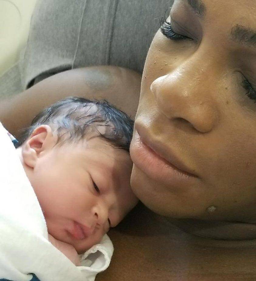 Συγκλονιστική Serena Williams: «Γιατί ήμουν τυχερή που έζησα μετά τη γέννηση της κόρης μου»