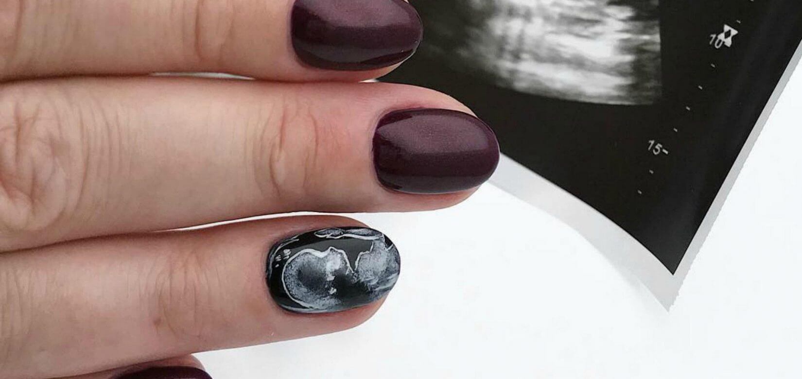 Sonogram nail art: Η νέα μόδα στα νύχια για τις μέλλουσες μανούλες!