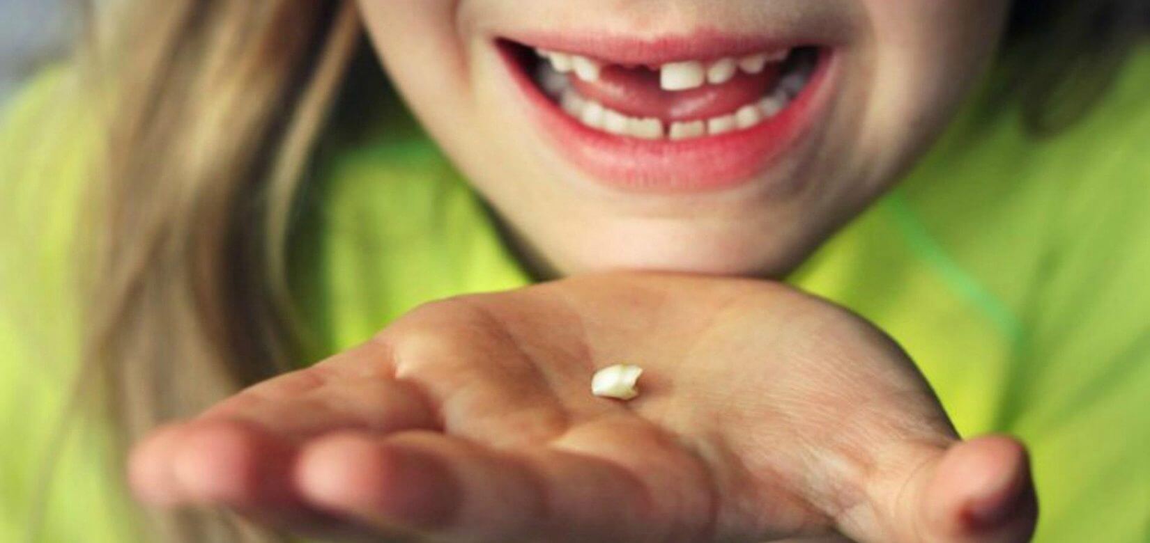 Υπάρχει σοβαρός λόγος που πρέπει να κρατάτε τα πρωτα δόντια του παιδιού σας