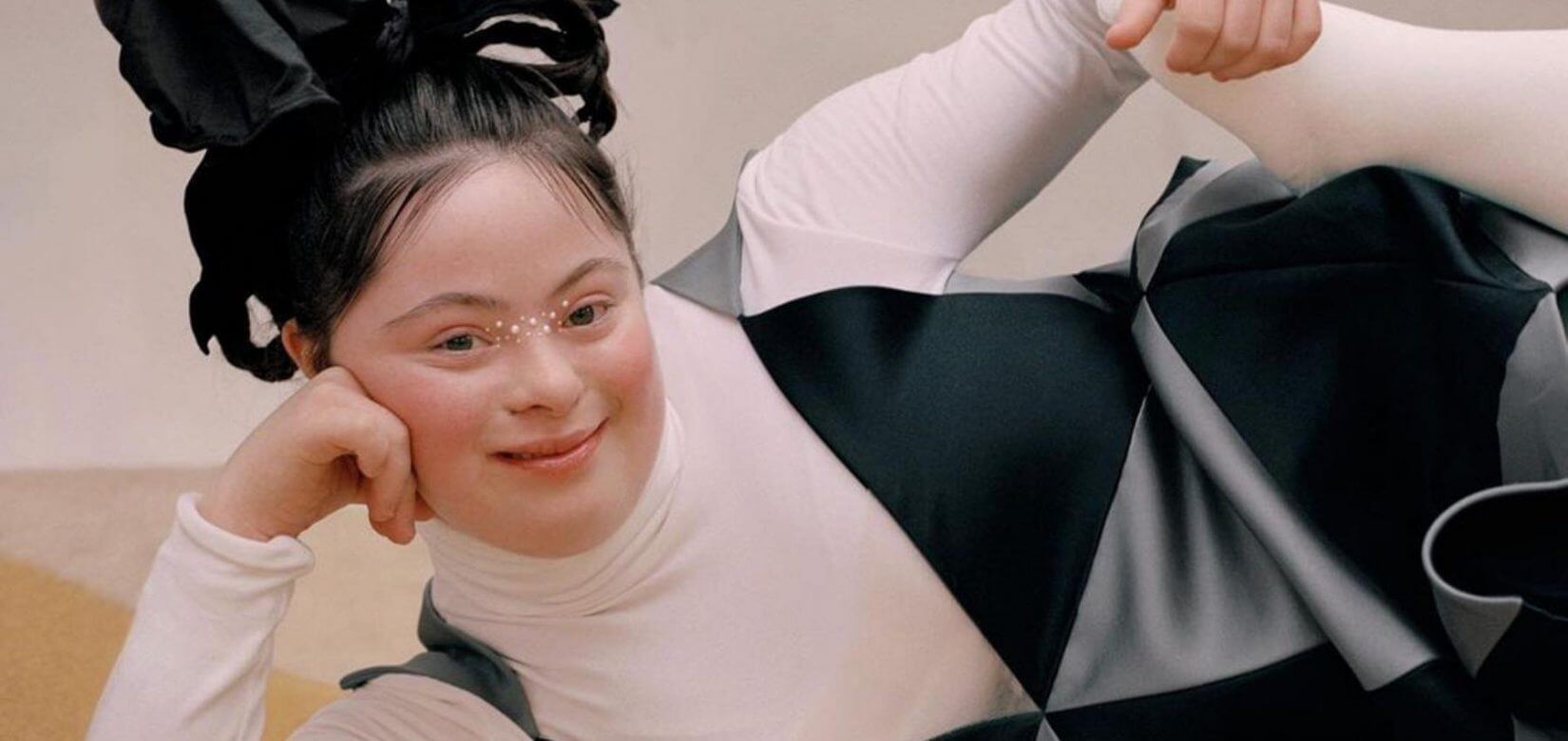 Ellie Goldstein: Το 18χρονο μοντέλο με σύνδρομο Down γράφει ιστορία στο εξώφυλλο του Allure