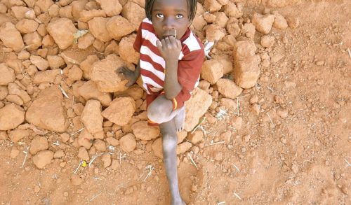 Aφρική: Παιδιά λόγω υποσιτισμού φαίνονται μικρότερα από την ηλικία τους