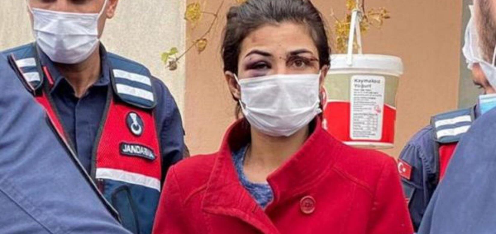 Τουρκία: Δικαίωση για την Μελέκ Ιπέκ που είχε σκοτώσει τον σύζυγο βασανιστή της (φωτό)