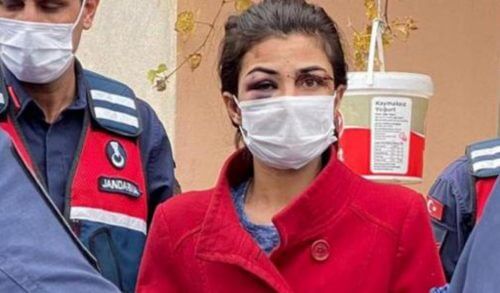 Τουρκία: Δικαίωση για την Μελέκ Ιπέκ που είχε σκοτώσει τον σύζυγο βασανιστή της (φωτό)