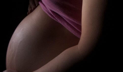 Ποιες είναι οι βασικότερες αλλαγές στο δέρμα στην εγκυμοσύνη;
