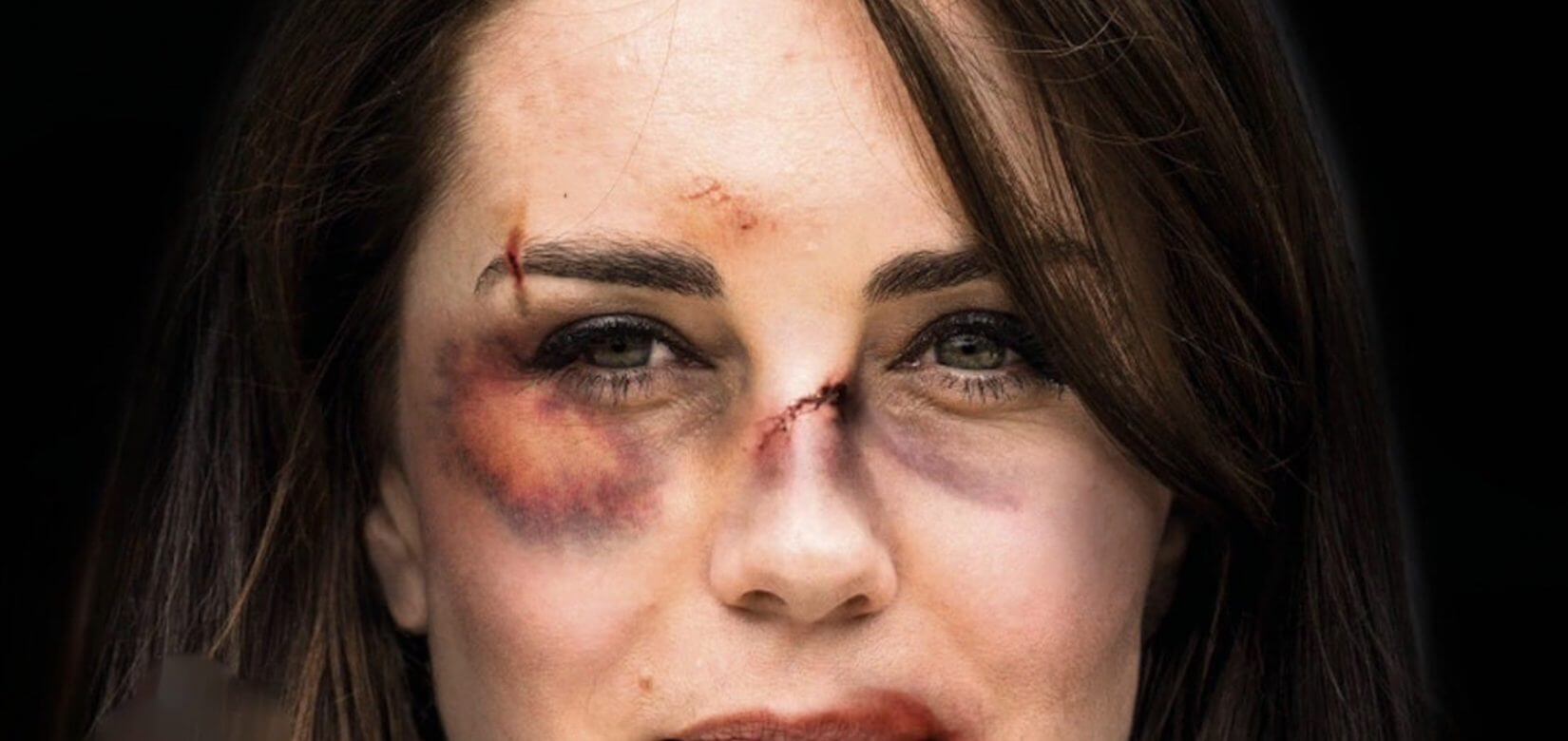 Κινδυνεύει η Κέιτ Μίντλετον να πέσει θύμα ενδοοικογενειακής βίας;