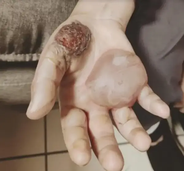 &Nu;έ&alpha; &Sigma;&mu;ύ&rho;&nu;&eta;: &Beta;ί&alpha;&zeta;&epsilon; &kappa;&alpha;&iota; &beta;&alpha;&sigma;ά&nu;&iota;&zeta;&epsilon; ά&gamma;&rho;&iota;&alpha; &tau;&eta; 10&chi;&rho;&omicron;&nu;&eta; &kappa;ό&rho;&eta; &tau;&omicron;&upsilon; - &Tau;&eta;&nu; έ&kappa;&alpha;&iota;&gamma;&epsilon; &sigma;&tau;&omicron; &ldquo;&mu;ά&tau;&iota;&rdquo; &tau;&eta;&sigmaf; &kappa;&omicron;&upsilon;&zeta;ί&nu;&alpha;&sigmaf; (&phi;&omega;&tau;ό)