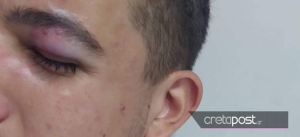 &Alpha;&pi;ί&sigma;&tau;&epsilon;&upsilon;&tau;&omicron;: &Omicron;&delta;&eta;&gamma;ό&sigmaf; &xi;&upsilon;&lambda;&omicron;&kappa;ό&pi;&eta;&sigma;&epsilon; &mu;&alpha;&theta;&eta;&tau;ή &epsilon;&pi;&epsilon;&iota;&delta;ή &tau;&omicron;&upsilon; έ&kappa;&alpha;&nu;&epsilon; &pi;&alpha;&rho;&alpha;&tau;ή&rho;&eta;&sigma;&eta; &gamma;&iota;&alpha; &tau;&eta; &delta;&iota;ά&beta;&alpha;&sigma;&eta; &pi;&epsilon;&zeta;ώ&nu;