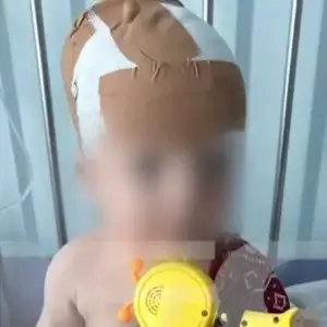Νέα Σμύρνη: Σκύλος της οικογένειας δάγκωσε το 11 μηνών μωρό στο κεφάλι