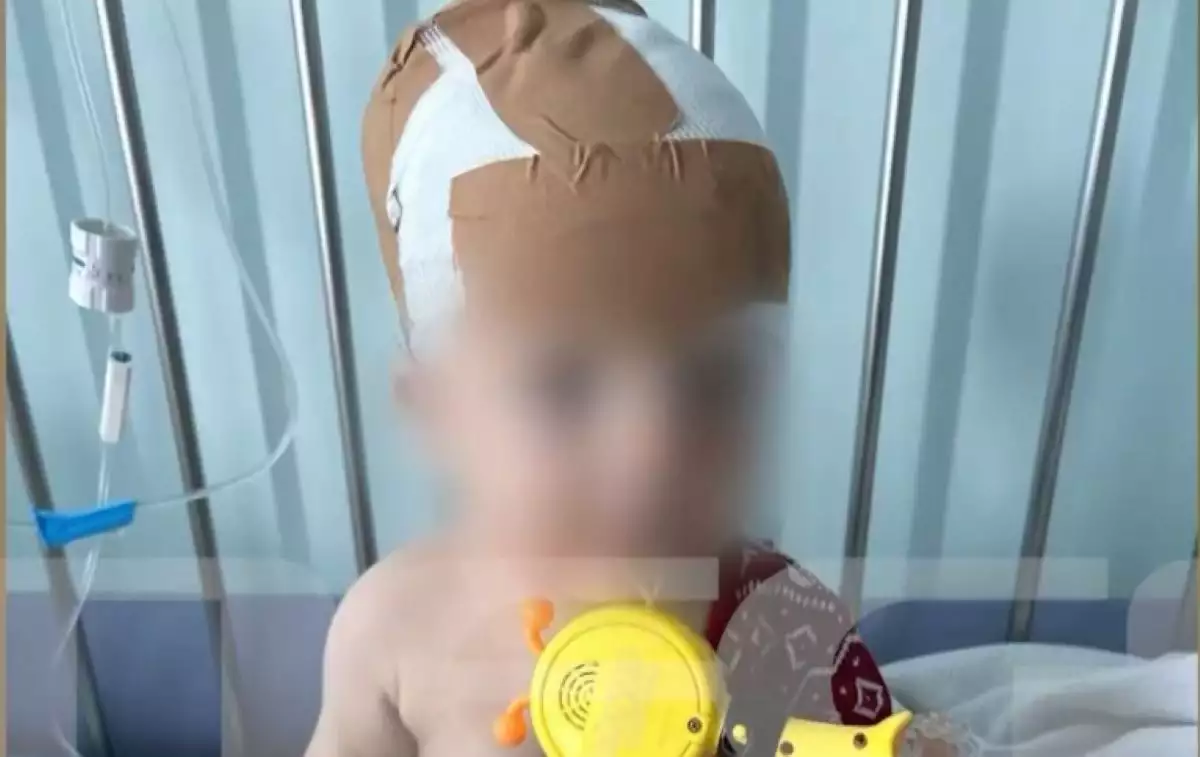 Νέα Σμύρνη: Σκύλος της οικογένειας δάγκωσε το 11 μηνών μωρό στο κεφάλι